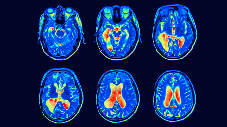 Nurturing Your Mental Health: Tips for Stress Management and Well-being