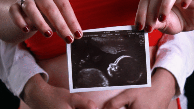 Ultrasound Surprise: Doctors Spot Baby’s Hair at 20 Week