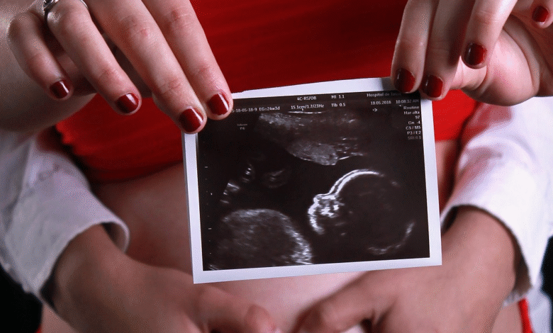 Ultrasound Surprise: Doctors Spot Baby’s Hair at 20 Week