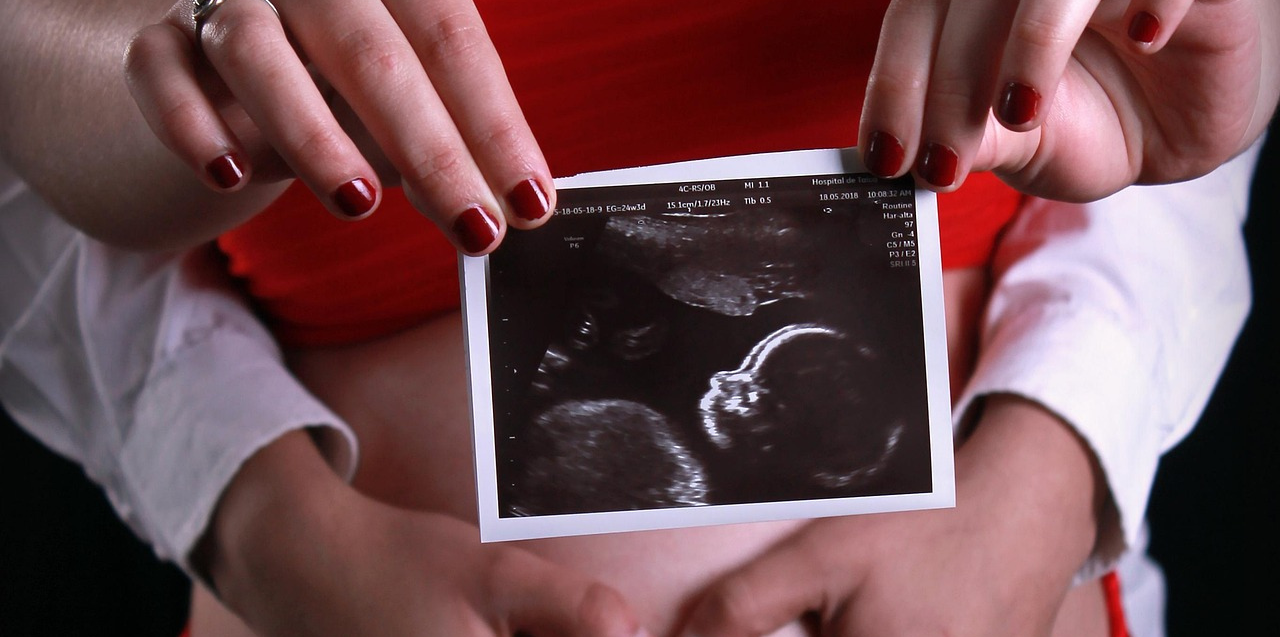 Ultrasound Surprise: Doctors Spot Baby’s Hair at 20 Week